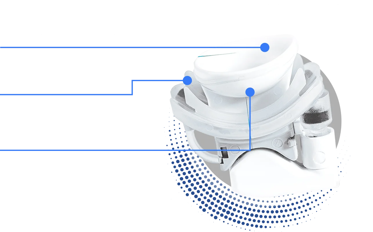 Dry Eye Treatment Diagram