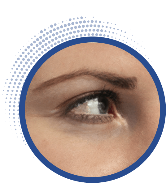 Dry eyes image